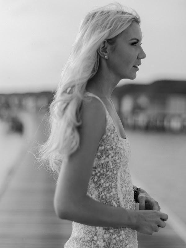 Shoulder, White, Hairstyle, Joint